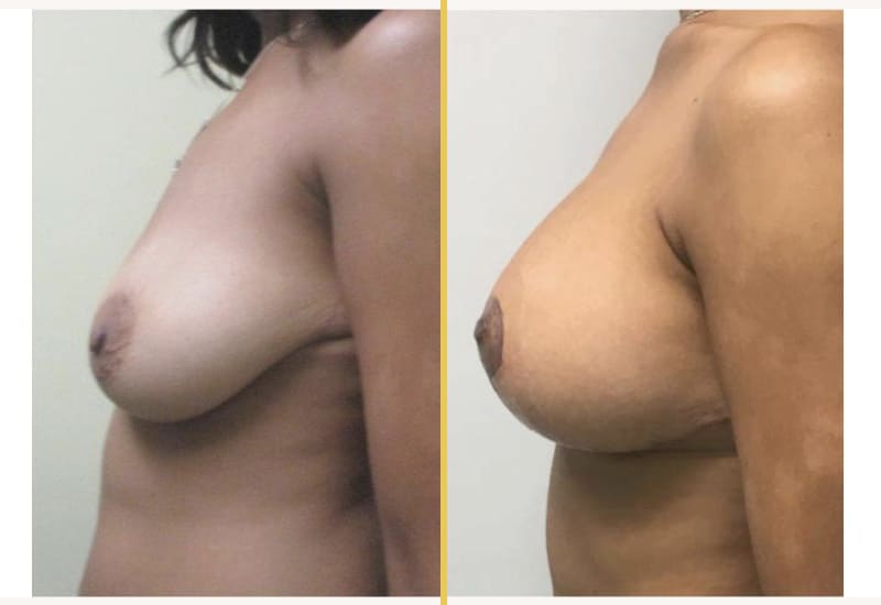 case 116