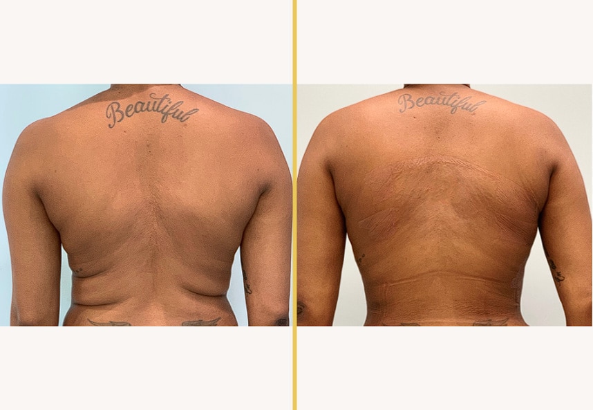 Case 0179