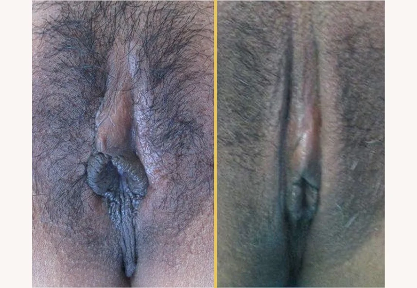 Case 0277