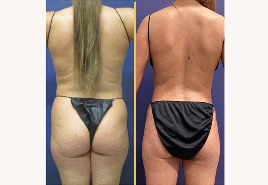 Case 031