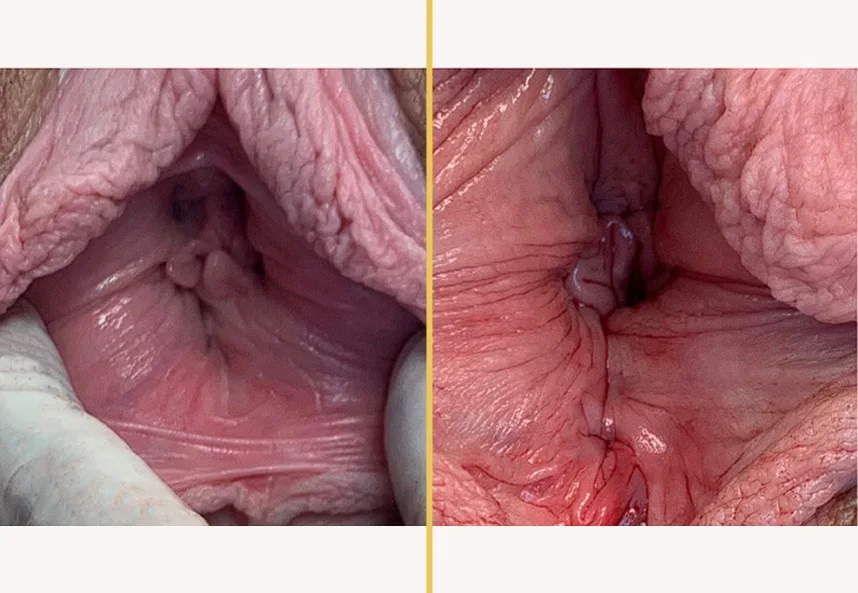 Case 0388