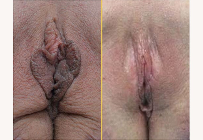 Case 245