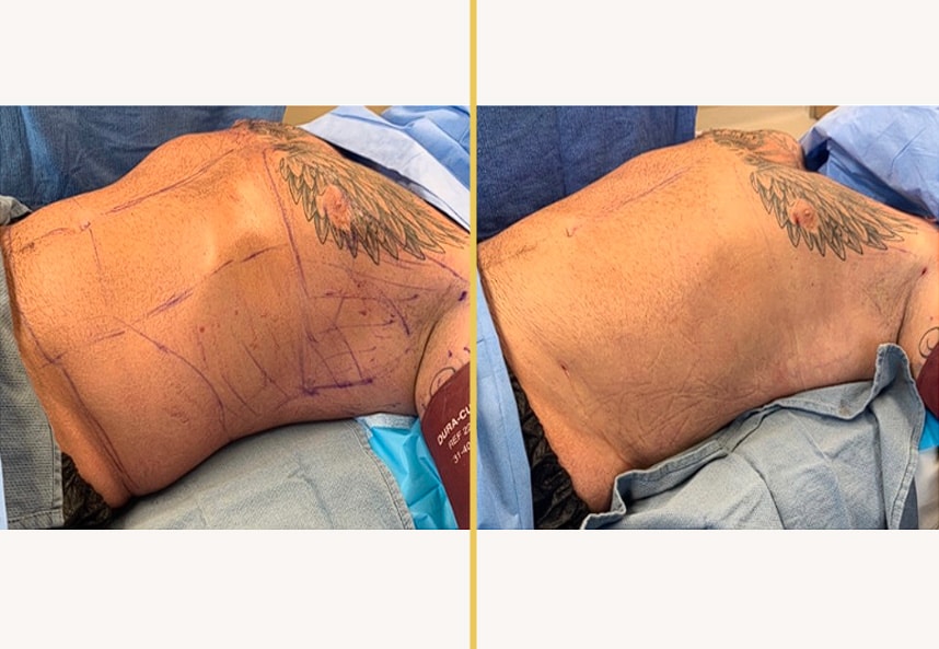 Case 0485