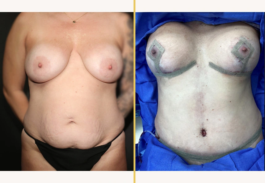 Case 657 A