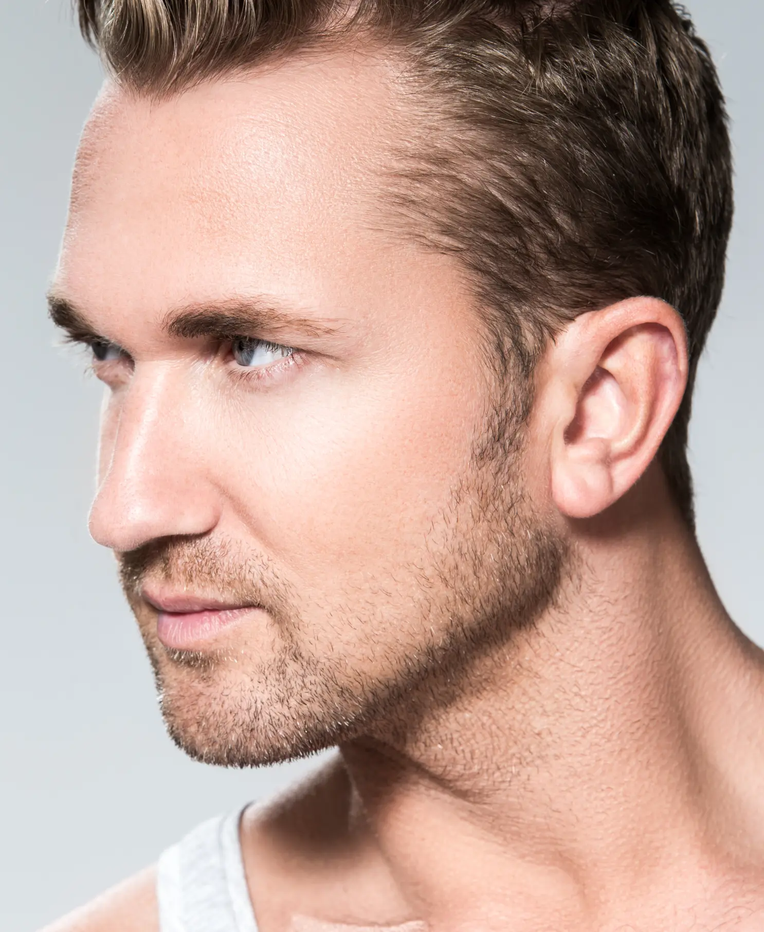 Ideal Candidate for Otoplasty
