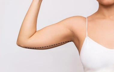 Upper Body Lift