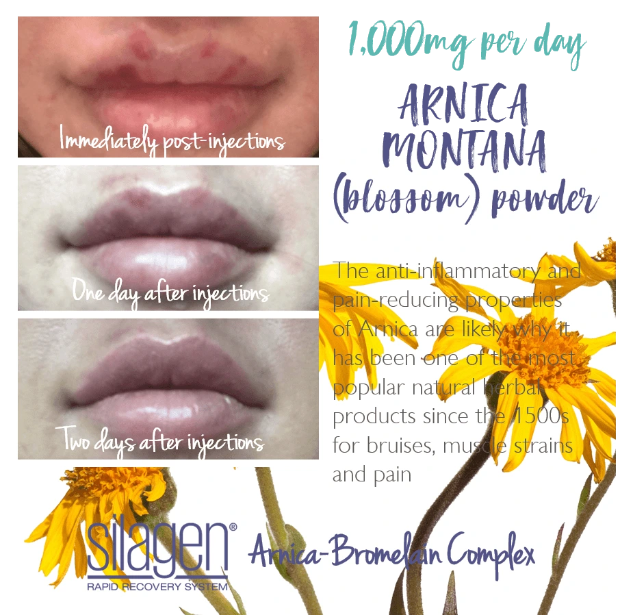 ABC_Arnica