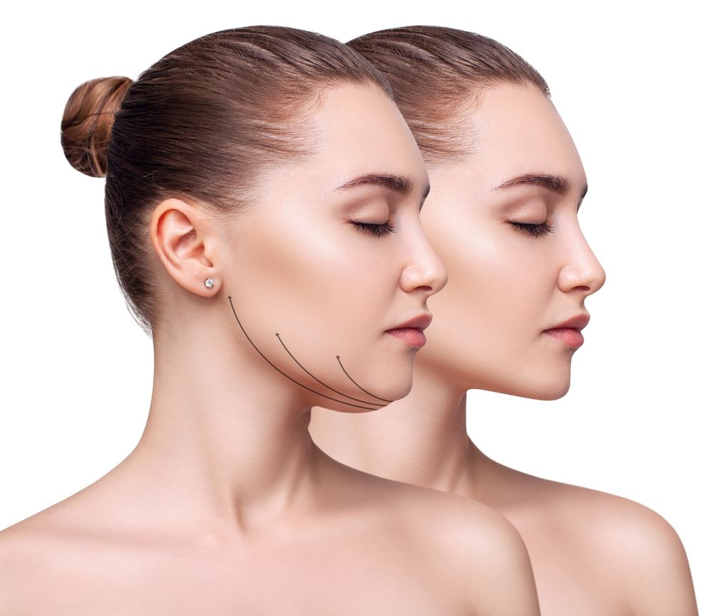 Chin Liposuction Arizona