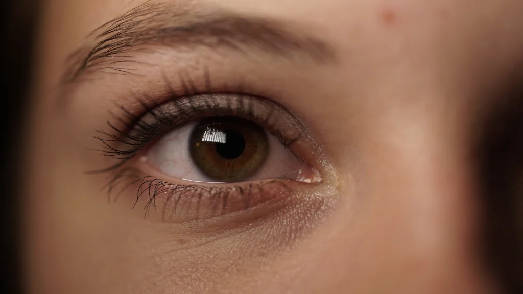 How to Treat Dark Circles? Top Treatments That Actually Work banner