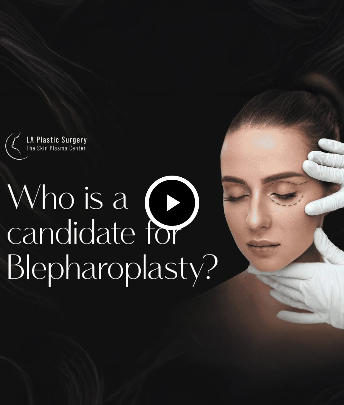 Eyelid Surgery Bradenton, FL: Ideal Candidate for Blepharoplasty Thumbnail