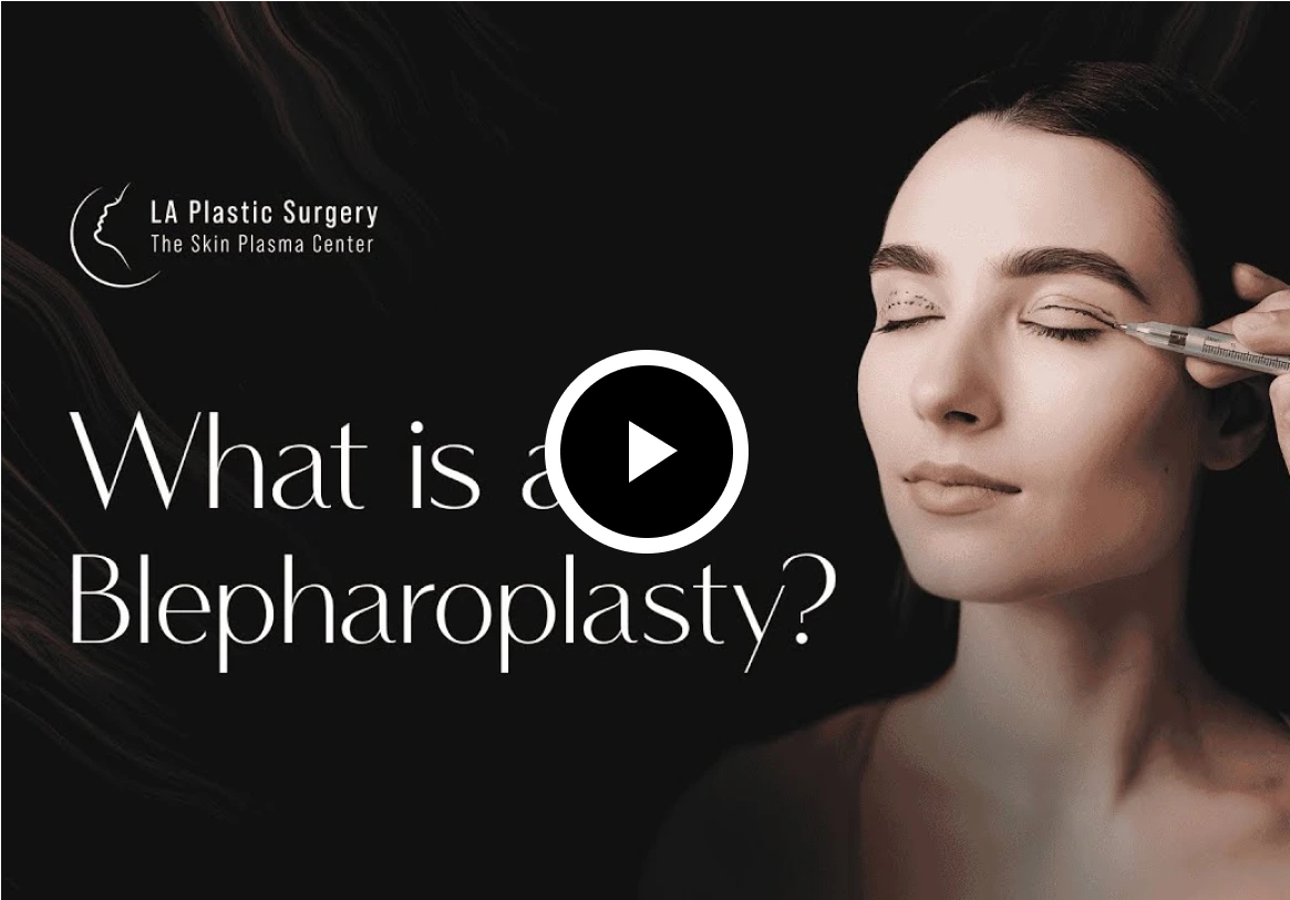 Blepharoplasty in Bradenton, FL: What Is Blepharoplasty? Thumbnail
