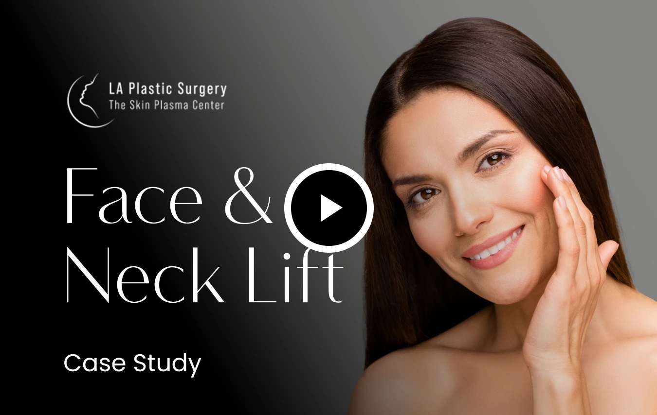 3 Types of Plasma Lyft Facelift Video Thumbnail