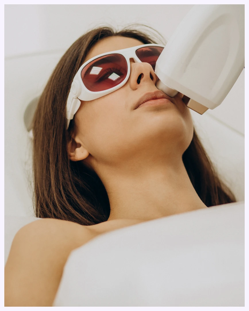 Laser hair removal treatment
