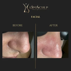 Before and After Facial Banner