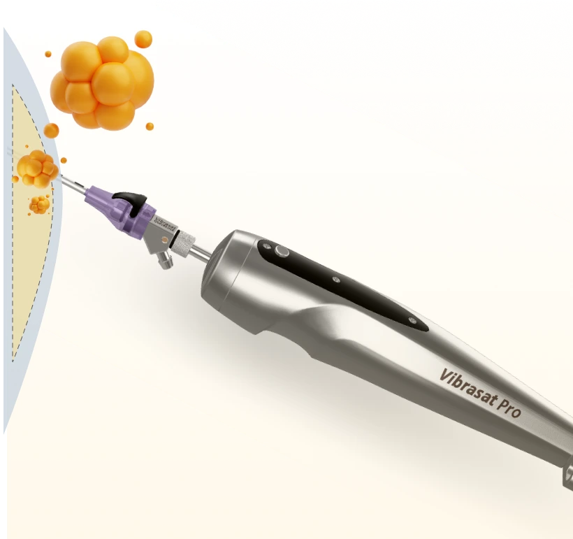 Our Signature Liposuction Technique - SculptX Banner