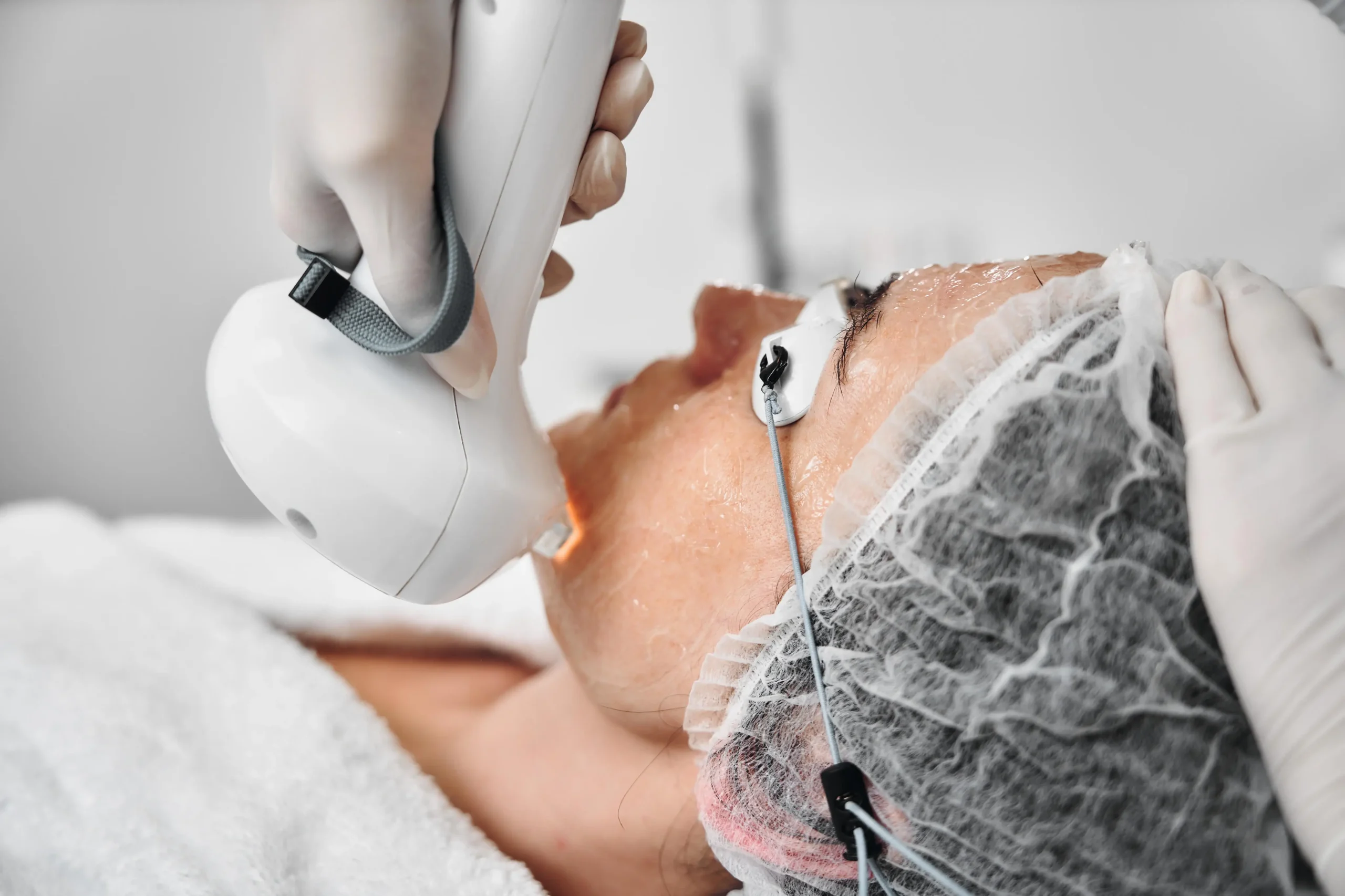 How Long Does Skin Heal After Laser Resurfacing? Banner
