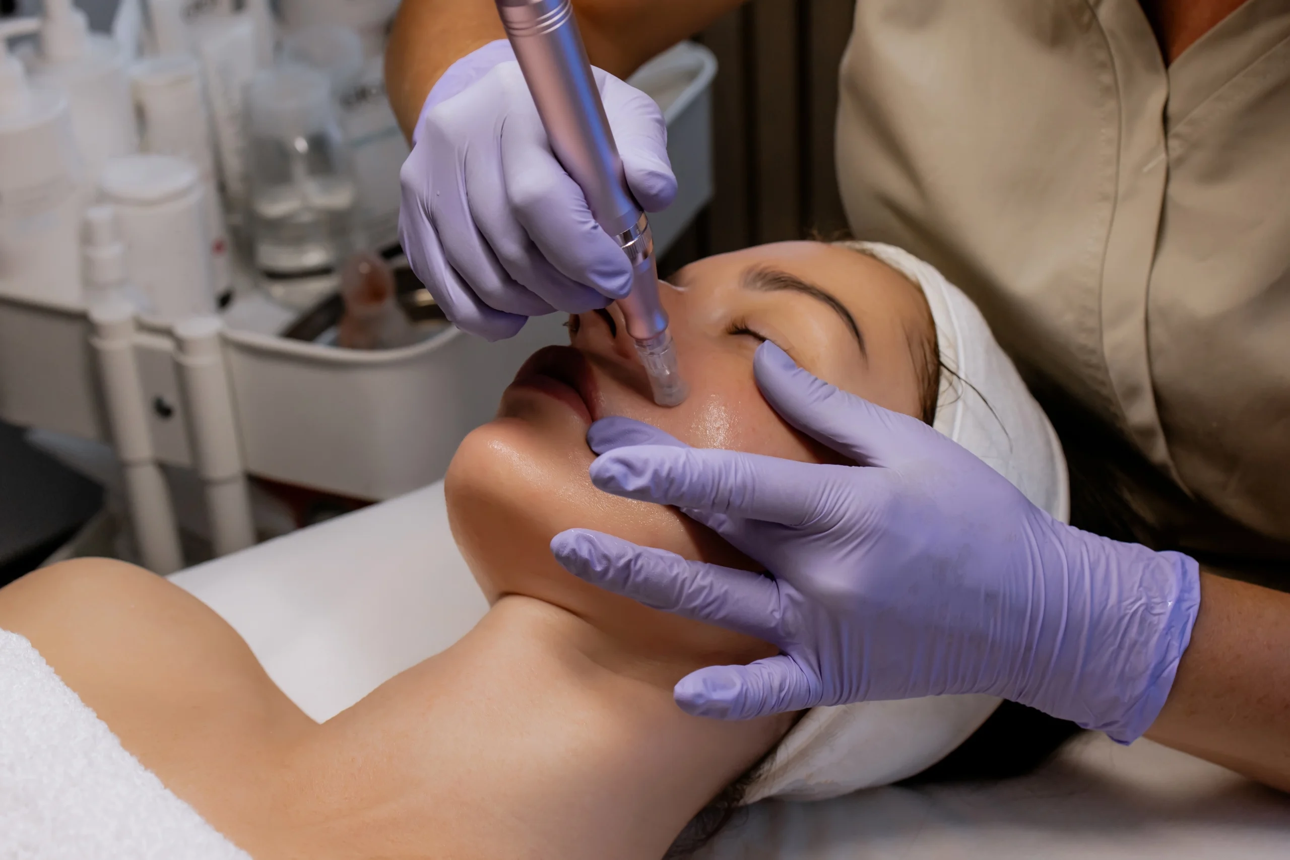 Microneedling vs Laser Treatment: Which Has Less Downtime? banner