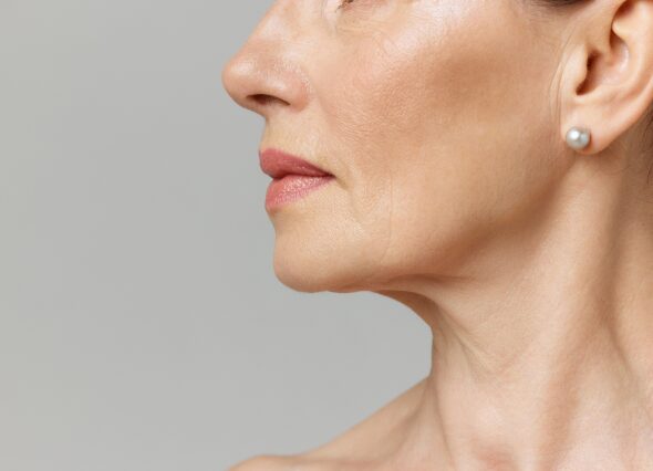 Candidates for Chin Liposuction Banner
