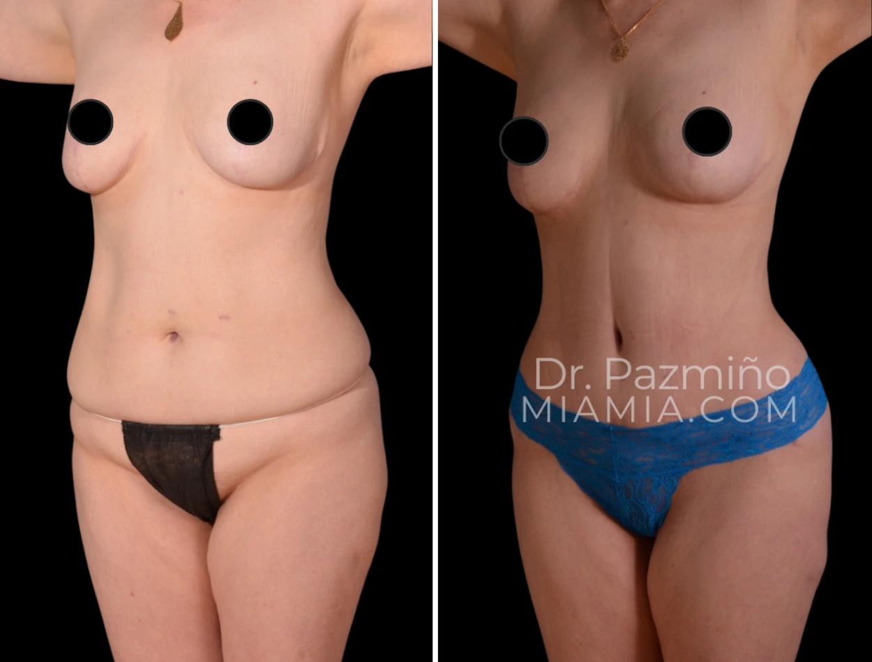 miamiaes (45)