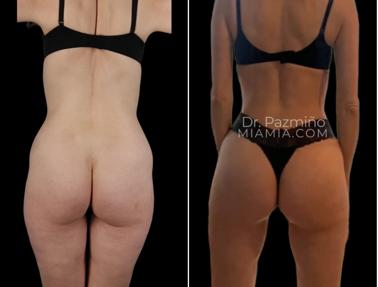 miamiaesthetic (78)