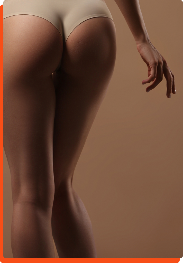 Brazilian Butt Lift Recovery Image
