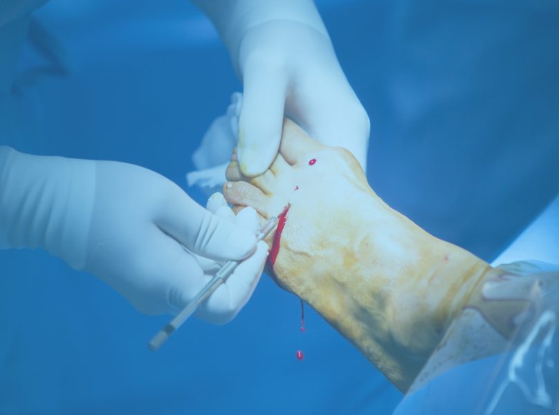 Treatments Provided by Ankle Pain Therapist: Ankle Surgery Banner