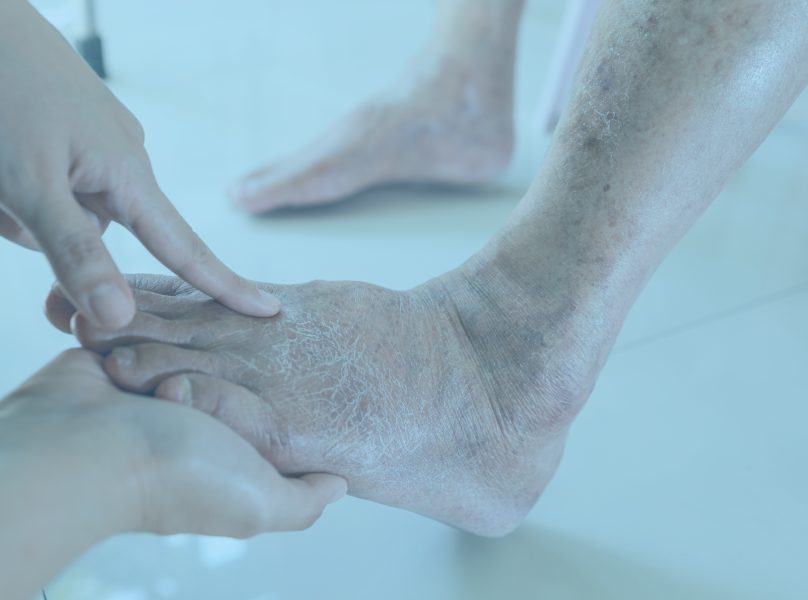 Treatments Provided by Our Ankle Pain Therapist: Geriatric Foot Care Banner