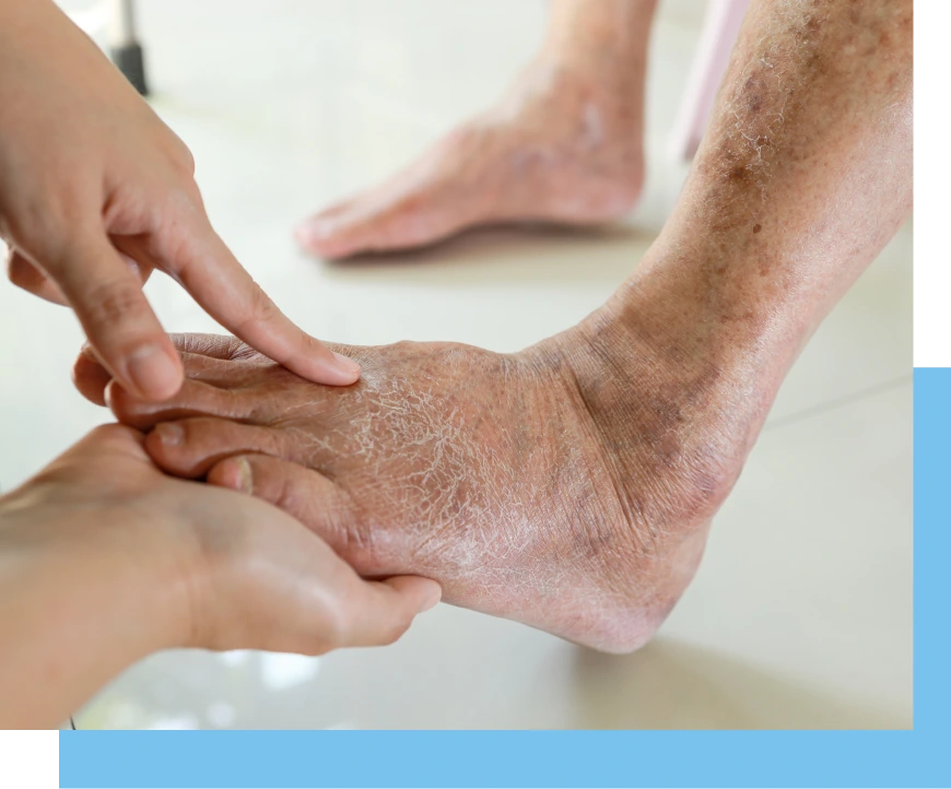 Diabetic Foot Treatment in Surfside, FL Banner