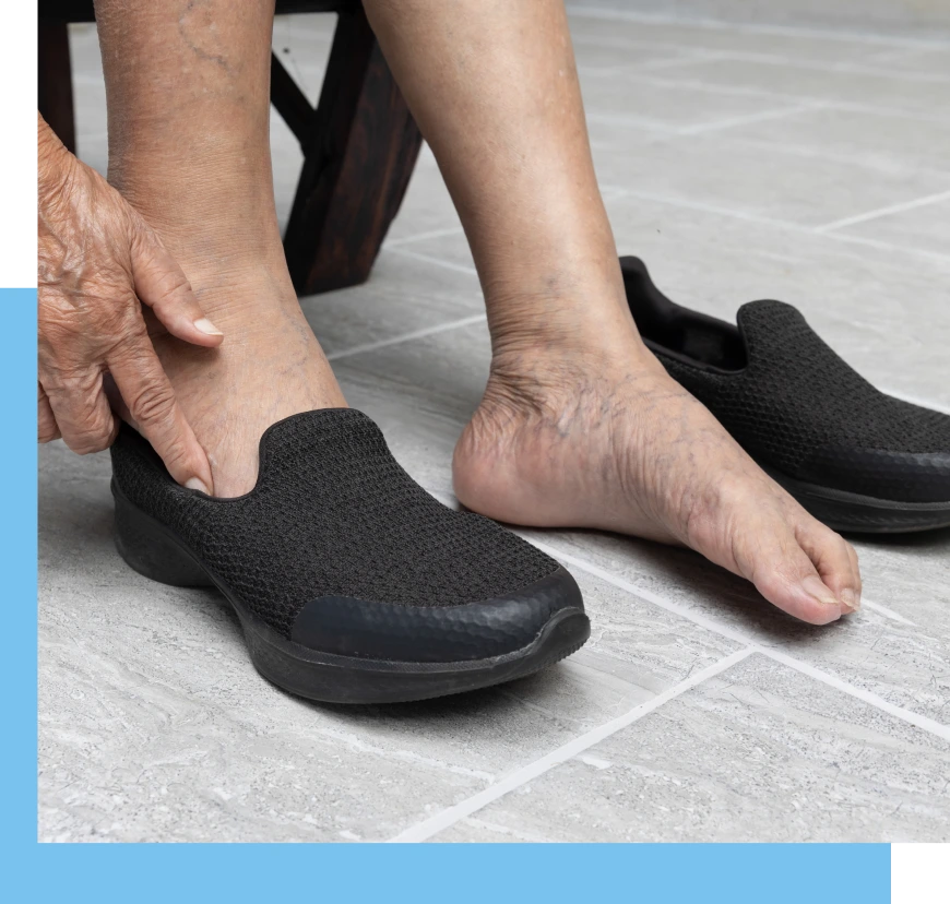 Diabetic Foot Treatment Surfside, FL Banner
