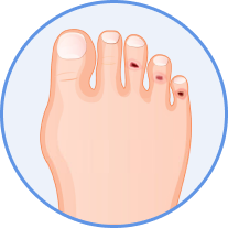 Corns Treatment in Novi, Southfield, Howell, and Livonia, MI Banner