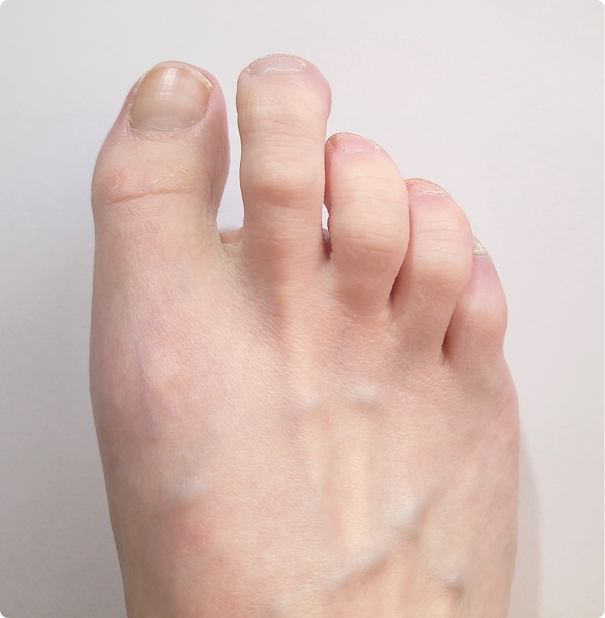 Foot & Ankle Surgery in Novi, Livonia, Howell, Southfield Banner