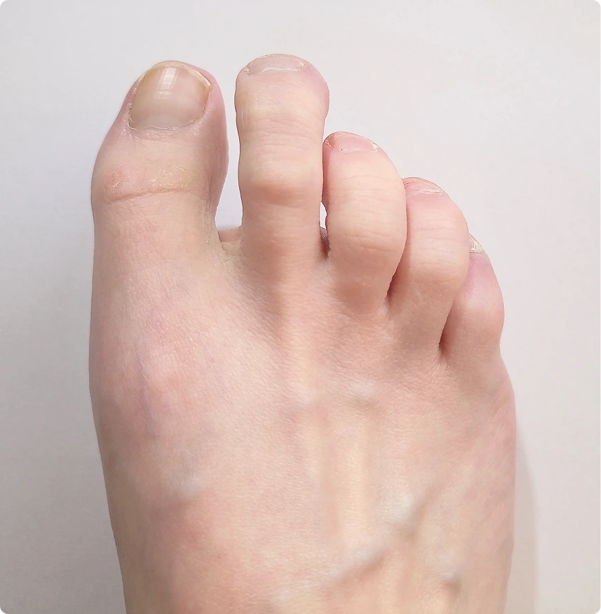 Foot & Ankle Surgery in Novi, Livonia, Howell, Southfield Banner