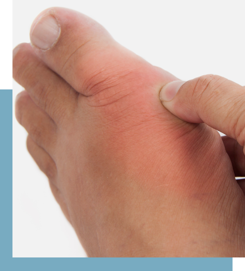 Treatment for Big Toe Arthritis NYC Banner
