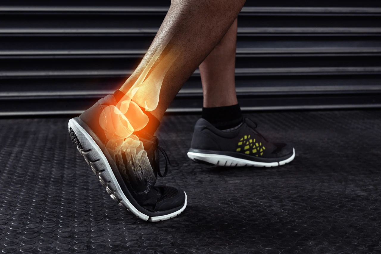 Ankle Sprain Pain Relief in New YC Banner