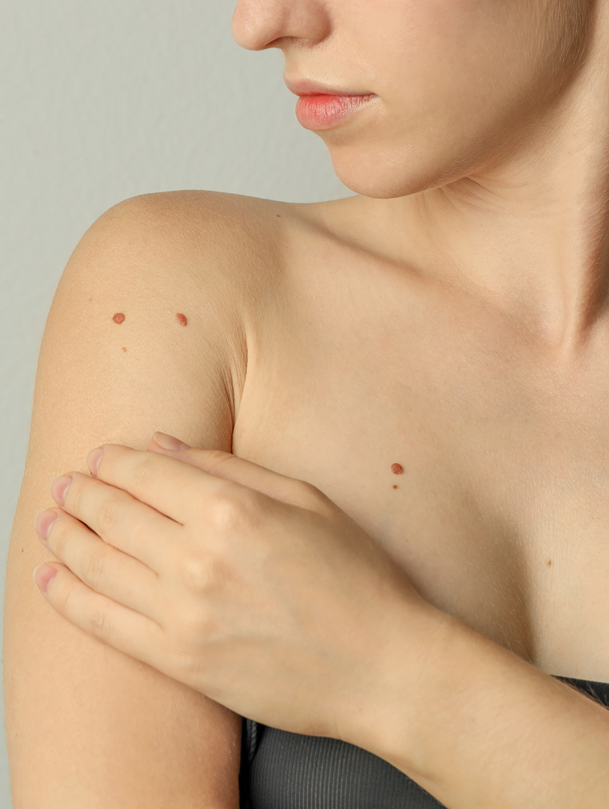 Medical Skin Biopsy in Fresno, CA Banner