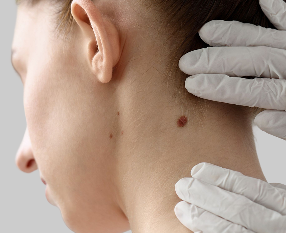 Skin Biopsy in Fresno, CA Banner