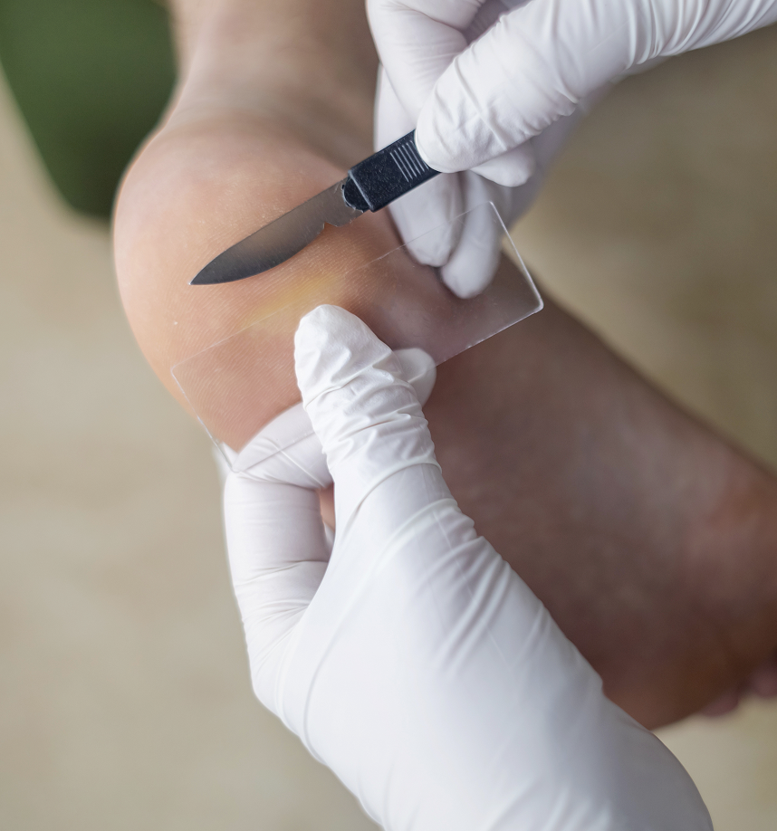 Skin Biopsy Procedure in Fresno, CA Banner