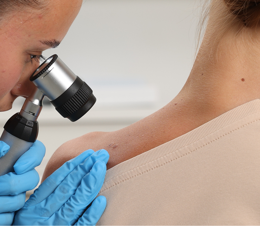 Skin Biopsy Treatment in Fresno, CA Banner
