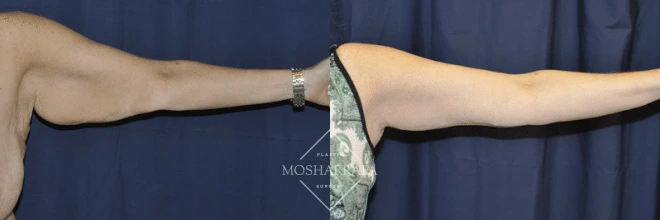 Case 122 (1)