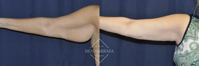 Case 122 (2)