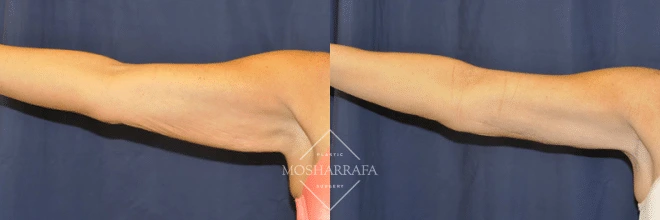 case 123 (4)