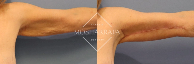 case 285 (3)