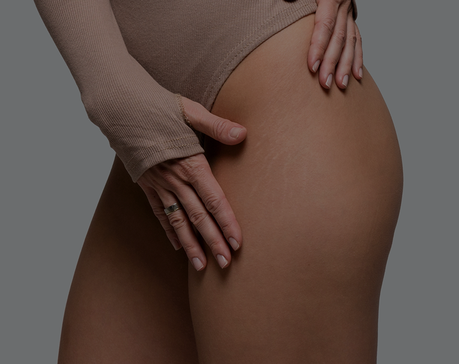 Thigh Lift in Phoenix & Scottsdale, AZ Banner