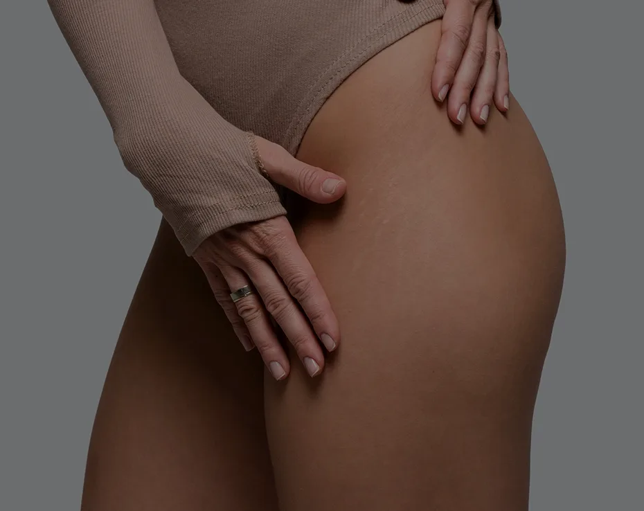 Thigh Lift in Phoenix & Scottsdale, AZ Banner