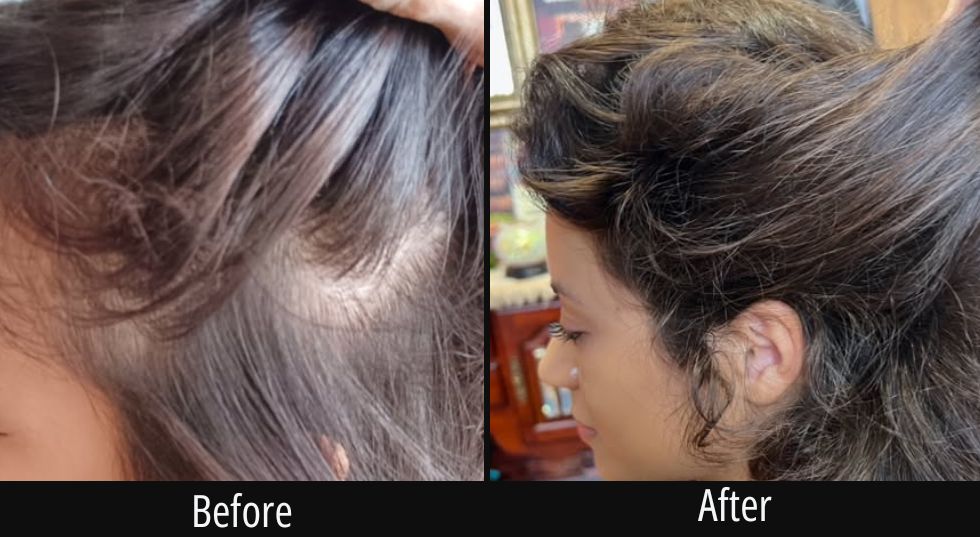 Before and after comparison of hair treatment showing improved texture and fullness