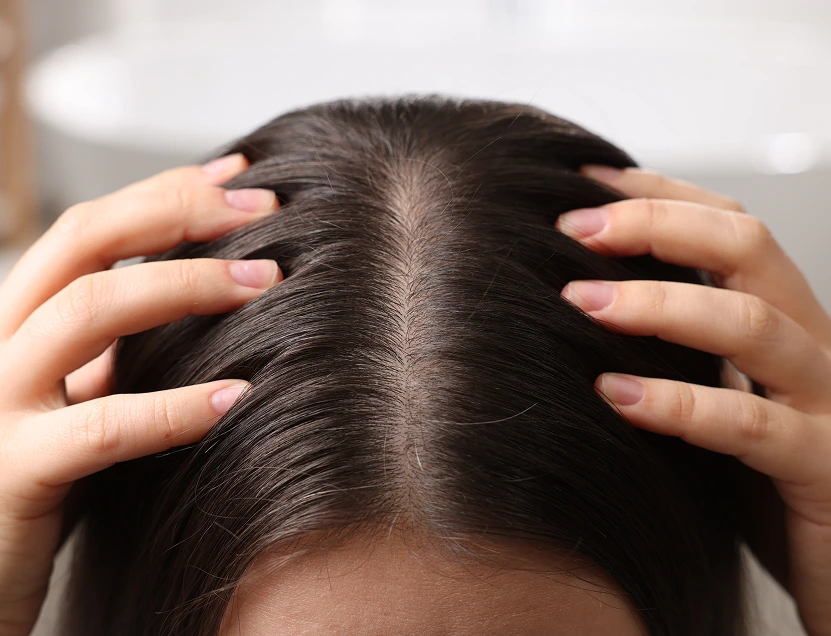 Person's hands on top of their head showing scalp and hair part