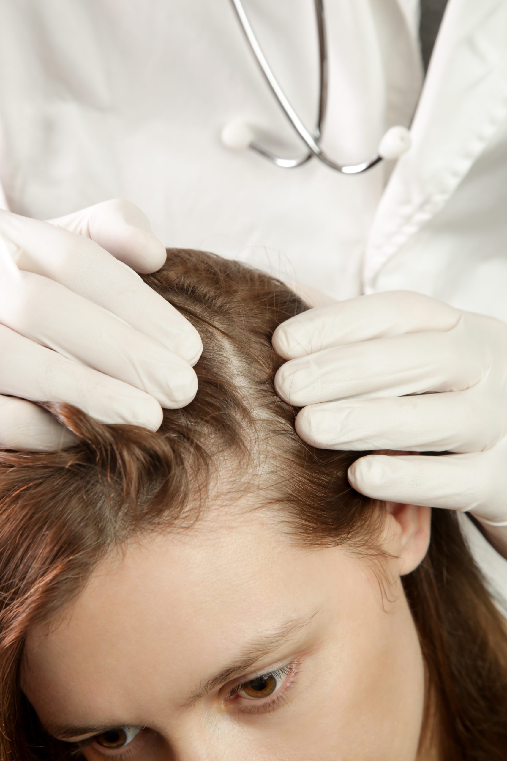 Medical professional in white coat and gloves examining patient's scalp with stethoscope visible