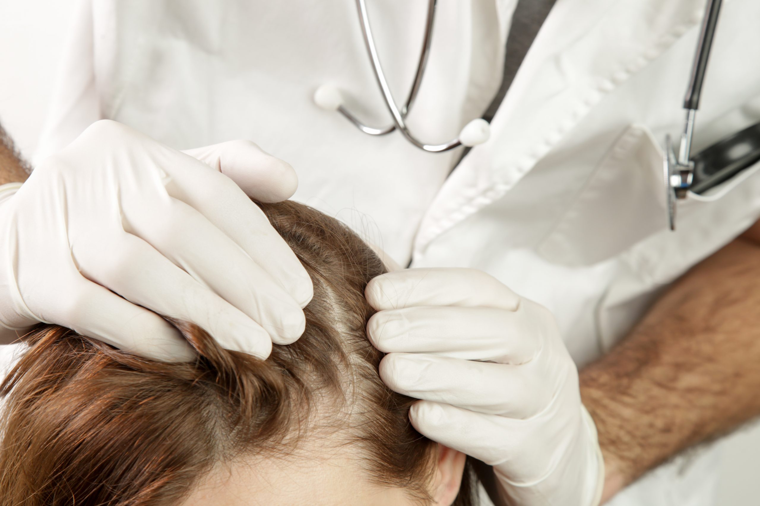 Healthcare provider in white coat and gloves examining patient's scalp with stethoscope visible