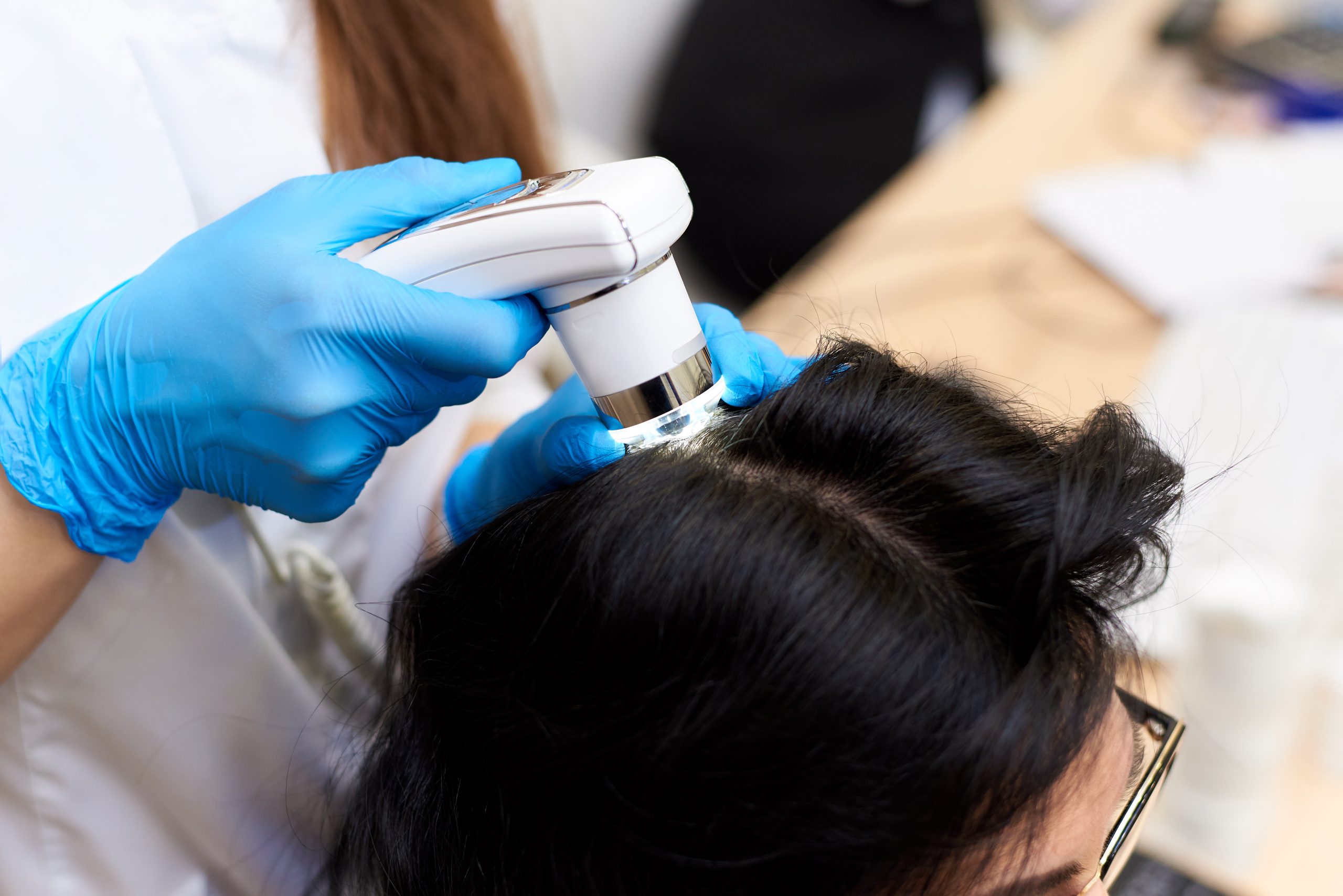 Practitioner in blue gloves applying handheld scalp device to patient's hair during clinical treatment