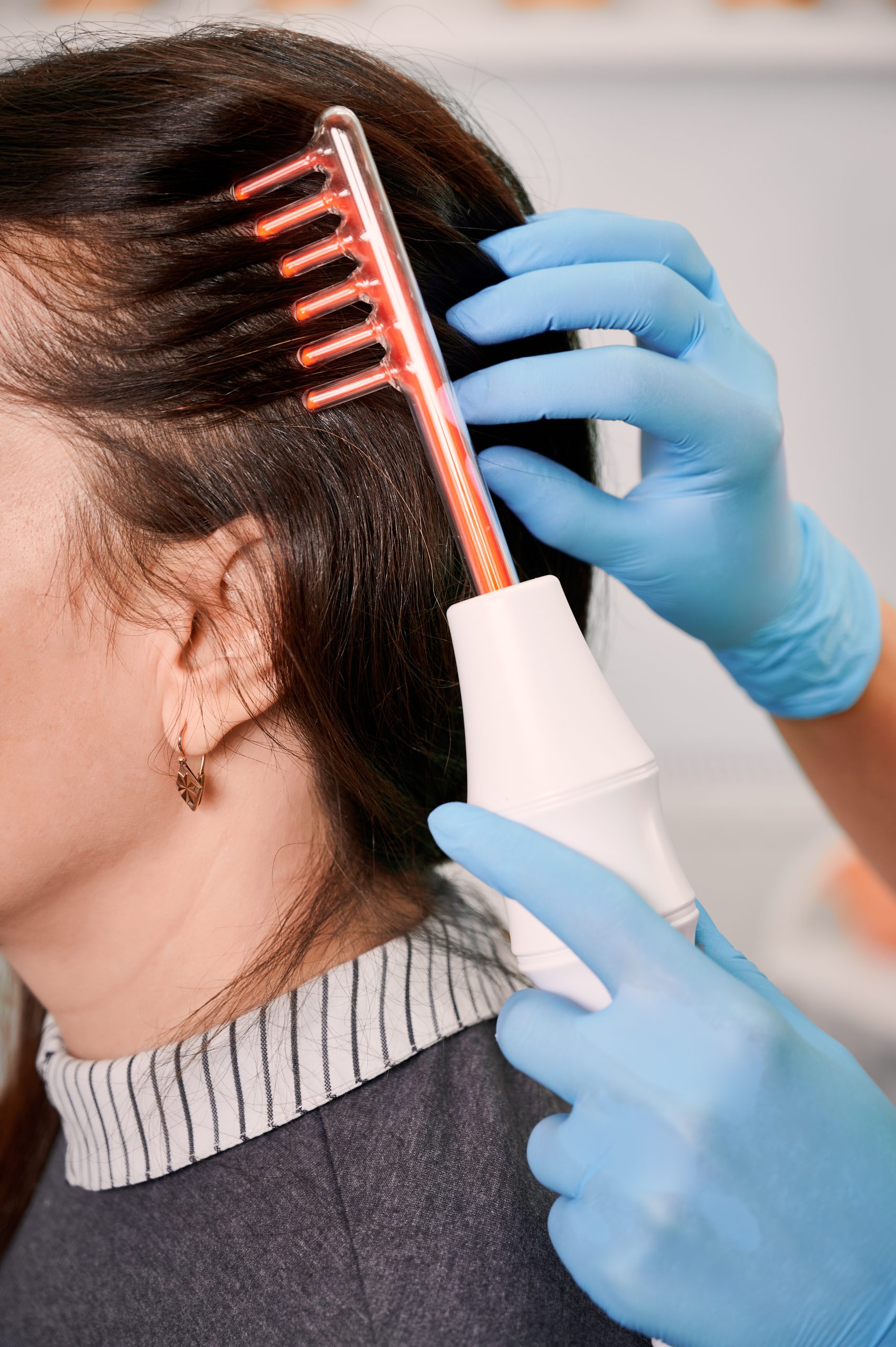 Clinician in blue gloves using red-light comb on patient's scalp hair